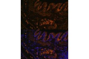 Immunofluorescence analysis of rat lung using MMP9 antibody (ABIN3022899, ABIN3022900, ABIN3022901, ABIN1513215 and ABIN6219286) at dilution of 1:100. (MMP 9 anticorps  (AA 538-707))
