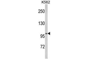 Western blot analysis of ATP12A Antibody (Center) in K562 cell line lysates (35ug/lane).