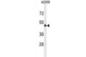 Western Blotting (WB) image for anti-Eyes Absent Homolog 4 (EYA4) antibody (ABIN3004136) (EYA4 anticorps)