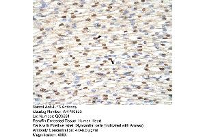 Rabbit Anti-ILF3 Antibody  Paraffin Embedded Tissue: Human Heart Cellular Data: Myocardial cells Antibody Concentration: 4. (Interleukin enhancer-binding factor 3 (ILF3) (N-Term) anticorps)