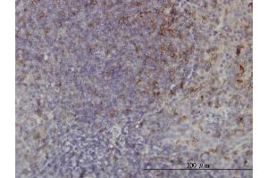 Immunoperoxidase of monoclonal antibody to USP33 on formalin-fixed paraffin-embedded human tonsil.
