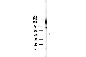anti-Dual Specificity Phosphatase 9 (DUSP9) (Internal Region) antibody
