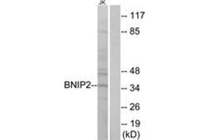 Western Blotting (WB) image for anti-BCL2/adenovirus E1B 19kDa Interacting Protein 2 (BNIP2) (AA 265-314) antibody (ABIN2890156) (BNIP2 anticorps  (AA 265-314))