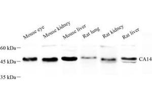 Western blot analysis of CA14 (ABIN7073311) at dilution of 1: 500 (CA14 anticorps)