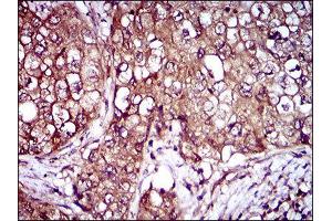 Immunohistochemistry (IHC) image for anti-Interleukin 3 Receptor, alpha (IL3RA) (AA 200-305) antibody (ABIN1845738) (IL3RA anticorps  (AA 200-305))