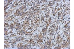 Image no. 1 for anti-Beaded Filament Structural Protein 1, Filensin (BFSP1) (AA 89-344) antibody (ABIN1496914)