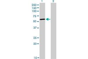 Western Blot analysis of POLK expression in transfected 293T cell line by POLK monoclonal antibody (M01), clone 6F2.