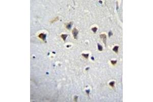 Immunohistochemistry analysis in formalin fixed and paraffin embedded human brain tissue reacted with NMDA Receptor 2A Antibody (Center) followed by peroxidase conjugation of the secondary antibody and DAB staining. (NMDAR2A anticorps  (Middle Region))