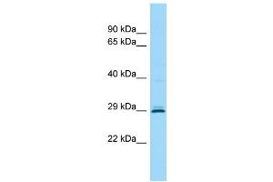 WB Suggested Anti-CEMP1 Antibody Titration: 1.