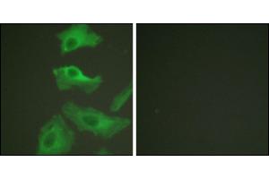 Immunofluorescence analysis of HeLa cells, treated with TNF-a (20nM, 15 mins), using HSP90B (Ab-254) antibody. (HSP90AB1 anticorps)