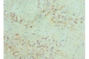 Immunohistochemistry of paraffin-embedded human gallbladder tissue using ABIN7150715 at dilution of 1:100 (MAP2K5 anticorps  (AA 1-190))