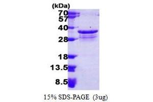 SDS-PAGE (SDS) image for Proteasome (Prosome, Macropain) Inhibitor Subunit 1 (PI31) (PSMF1) (AA 1-271) protein (His tag) (ABIN666623)