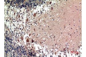 Immunohistochemistry (IHC) analysis of paraffin-embedded Human Brain, antibody was diluted at 1:100. (5HT1D anticorps)