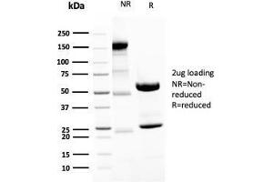 SDS-PAGE Analysis of Purified Neurofilament Rabbit Recombinant Monoclonal Antibody (NEFL.