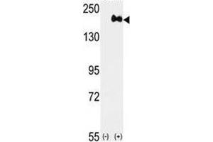 Western blot analysis of anti-HER2 antibody and 293 cell lysate (2 ug/lane) either nontransfected (Lane 1) or transiently transfected with the ERBB2 gene (2). (ErbB2/Her2 anticorps  (AA 1227-1255))