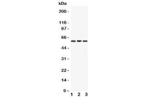 Western blot testing of Dopamine Receptor D5 antibody and Lane 1:  rat brain