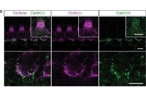 Localization of the different CaMKIIs in the organ of Corti. (CAMK2D anticorps)