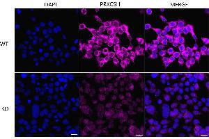 Immunocytochemical staining of HeLa cells using PRKCSH antibody (ABIN7799984), 1:1,000), Top panel: wild-type (WT), Bottom panal: PRKCSH shRNA knockdown (KD). (Recombinant PRKCSH anticorps)