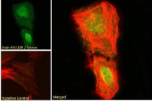 ABIN185086 Immunofluorescence analysis of paraformaldehyde fixed U2OS cells, permeabilized with 0.