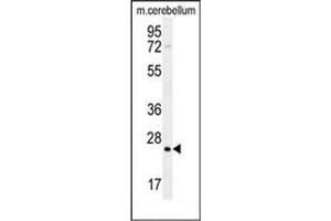 Western blot analysis of HRAS Antibody (C-term) in mouse cerebellum tissue lysates (35ug/lane).