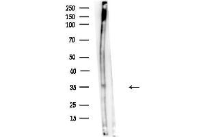 anti-CPX Chromosome Region, Candidate 1 (CPXCR1) antibody