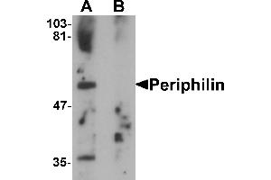 Western blot analysis of Periphilin in mouse colon tissue lysate with Periphilin antibody at 1 µg/mL in (A) the absence and (B) the presence of blocking peptide. (PPHLN1 anticorps  (Middle Region))