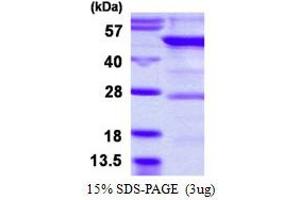 Image no. 1 for Tyrosyl-tRNA Synthetase 2, Mitochondrial (YARS2) (AA 17-477) protein (His tag) (ABIN6386964)