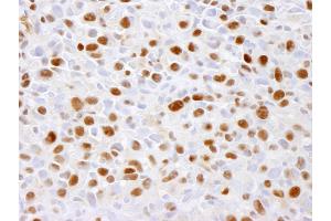 Immunohistochemistry (IHC) image for anti-Minichromosome Maintenance Complex Component 2 (MCM2) (pSer41) antibody (ABIN7448648) (MCM2 anticorps  (pSer41))