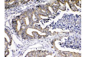 IHC analysis of TNFSF18 using anti-TNFSF18 antibody .