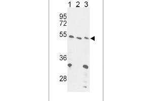 Western blot analysis of FOXP3 Antibody (C-term) (ABIN389295 and ABIN2839415) in 293(lane 1), Jurkat cell line(lane 2) and mouse liver tissue(lane 3) lysates (35 μg/lane). (FOXP3 anticorps  (C-Term))