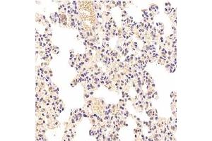 Immunohistochemistry analysis of paraffin-embedded rat lung using,HIPK2 (ABIN7074255) at dilution of 1: 1000 (HIPK2 anticorps)