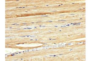 IHC image of ABIN7165118 diluted at 1:300 and staining in paraffin-embedded human skeletal muscle tissue performed on a Leica BondTM system.
