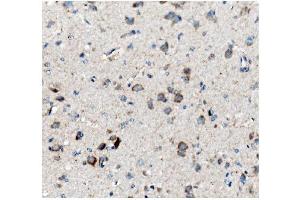 IHC analysis of Ch TOG/CKAP5 using anti-Ch TOG/CKAP5 antibody (ABIN7599106). (CKAP5 anticorps  (AA 1-221))