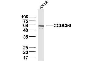 Lane 1: A549 lysates probed with CCDC96 Polyclonal Antibody, Unconjugated  at 1:300 overnight at 4˚C. (CCDC96 anticorps  (AA 301-400))