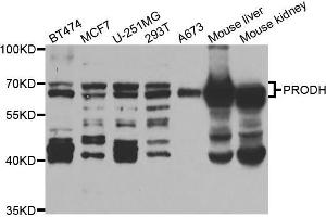 Western blot analysis of extracts of various cell lines, using PRODH antibody (ABIN5973448) at 1/1000 dilution. (PRODH anticorps)
