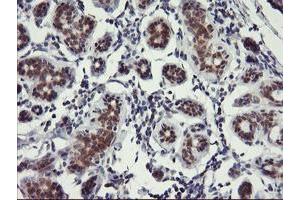 anti-Ubiquitin Specific Peptidase 10 (USP10) antibody