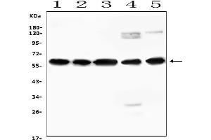 Western blot analysis of AVPR1A using anti-AVPR1A antibody (ABIN7601713).