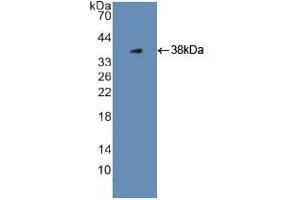 WB of Protein Standard: different control antibodies against Highly purified E. (PLG Kit CLIA)