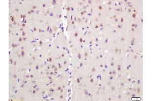 Formalin-fixed and paraffin embedded mouse brain labeled with Rabbit Anti-NARC1 Polyclonal Antibody, Unconjugated (ABIN761831) at 1:200 followed by conjugation to the secondary antibody and DAB staining (PCSK9 anticorps  (AA 231-330))