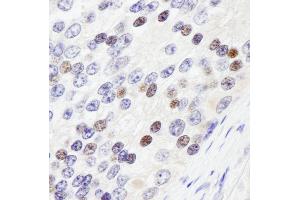 anti-Zinc Fingers and Homeoboxes 3 (ZHX3) (AA 906-956) antibody