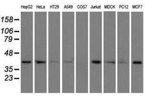 Image no. 7 for anti-Acetyl-CoA Acetyltransferase 2 (ACAT2) antibody (ABIN1496403) (ACAT2 anticorps)