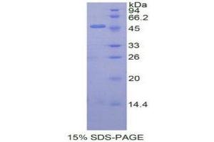 SDS-PAGE (SDS) image for Interferon, beta 1, Fibroblast (IFNB1) (AA 22-186) protein (His tag,GST tag) (ABIN1877223) (IFNB1 Protein (AA 22-186) (His tag,GST tag))