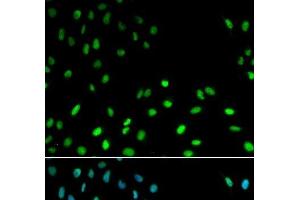 Immunofluorescence analysis of MCF-7 cells using RFC1 Polyclonal Antibody (RFC1 anticorps)