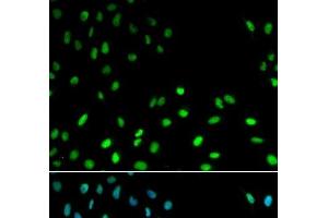 Immunofluorescence analysis of MCF-7 cells using RFC1 Polyclonal Antibody (RFC1 anticorps)