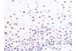 Immunohistochemistry of paraffin-embedded human esophageal using SUMO2/3 Rabbit mAb (ABIN7270370) at dilution of 1:100 (40x lens).