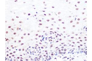 Immunohistochemistry of paraffin-embedded human esophageal using SUMO2/3 Rabbit mAb (ABIN7270370) at dilution of 1:100 (40x lens). (SUMO2 anticorps)