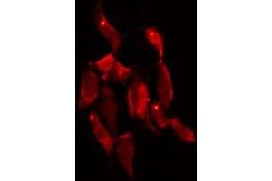 ABIN6279864 staining 293 by IF/ICC. (SYT10 anticorps)