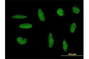 Immunofluorescence of purified MaxPab antibody to ZNF383 on HepG2 cell. (ZNF383 anticorps  (AA 1-475))