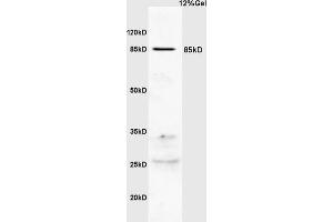 Human colon carcinoma lysates probed with Anti PI 3 Kinase p85 beta Polyclonal Antibody, Unconjugated (ABIN754723) at 1:200 overnight at 4 °C. (PIK3R2 anticorps)