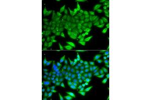 Immunofluorescence analysis of A549 cells using TTF2 antibody. (TTF2 anticorps  (AA 1-270))